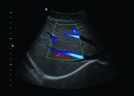Apogee 2300 Ultrasound Machine- 4D - Image 6
