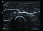 Apogee 2300 Ultrasound Machine- 4D - Image 7