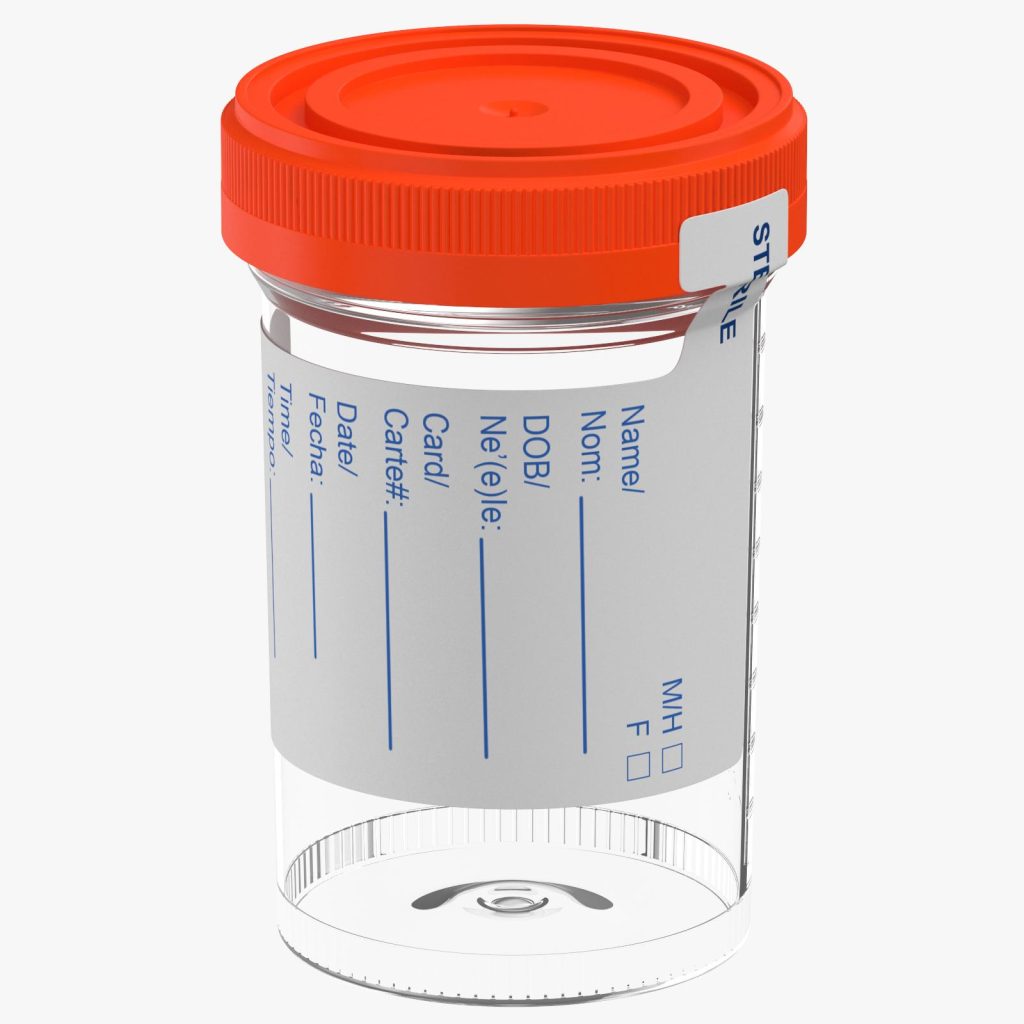 Urine bottles / 100’s