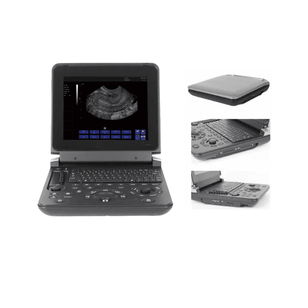 Alternative view of Ultrasound Machine – 12 Inch