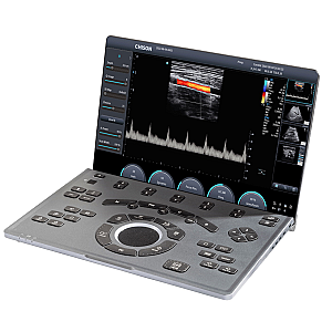 Alternative view of Chison SonoAir 30 Portable Ultrasound System + Trolley
