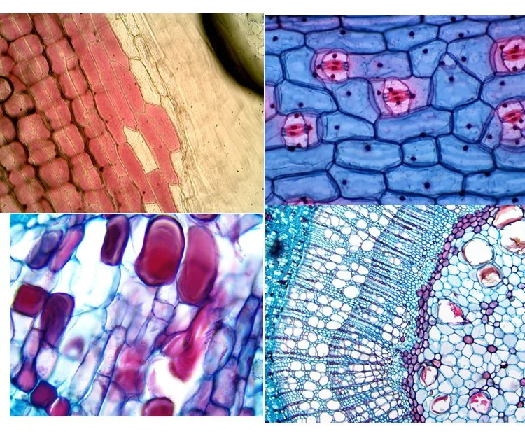 Z110-THD9 Biological Quality Lab Trinocular Compound Microscope with Digital Screen - Image 9