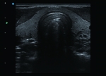 Apogee 2300 Ultrasound Machine- 4D - Image 11