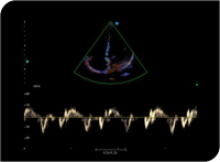 Apogee 2300 Ultrasound Machine- 4D - Image 9