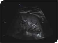 Apogee 2300 Ultrasound Machine- 4D - Image 8