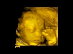 Apogee 2300 Ultrasound Machine- 4D - Image 12