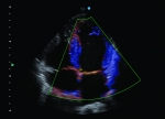 Apogee 2300 Ultrasound Machine- 4D - Image 3