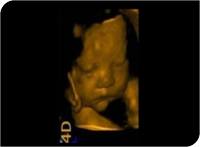 Apogee 2300 Ultrasound Machine- 4D - Image 4