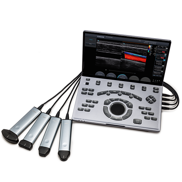 Chison SonoAir 30 Portable Ultrasound System