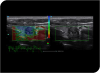 Apogee 2300 Ultrasound Machine- 4D - Image 5