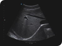 Apogee 2300 Ultrasound Machine- 4D - Image 13