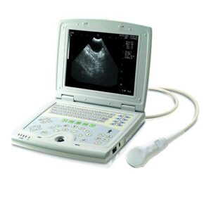 KX5000 Laptop Ultrasound