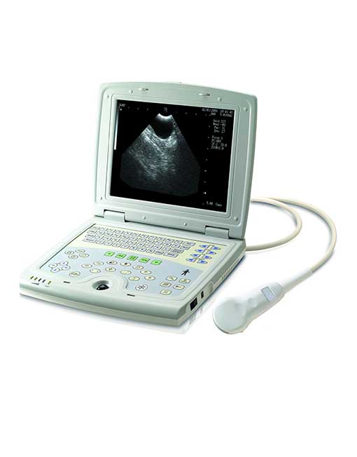 KX5000 Laptop Ultrasound