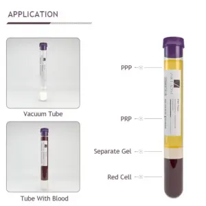 Alternative view of PRP Kit Accessories