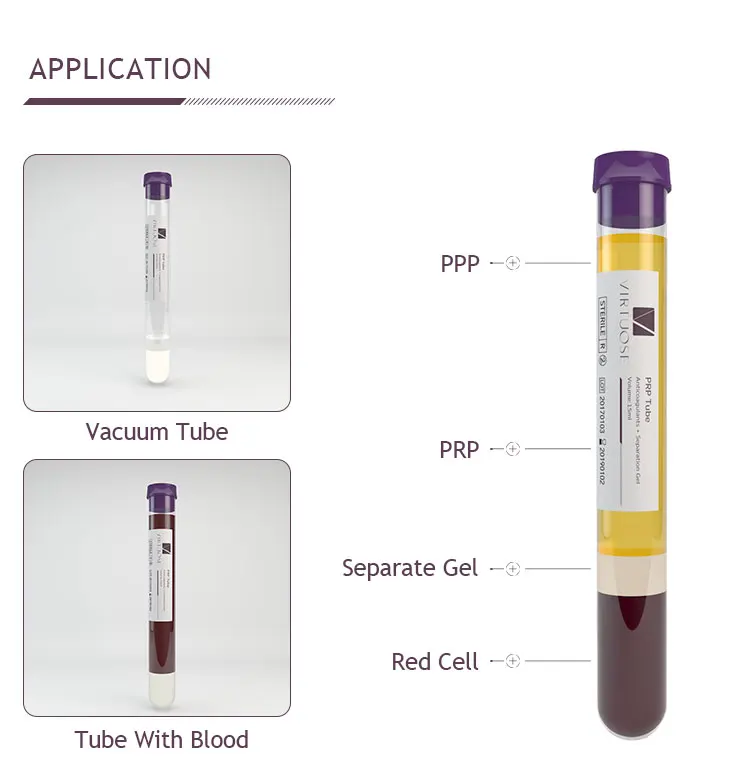 PRP Kit Accessories - Image 2
