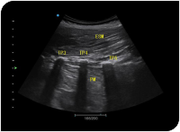 Apogee 2300 Ultrasound Machine- 4D - Image 14