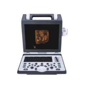 Apogee 2100 Ultrasound Machine
