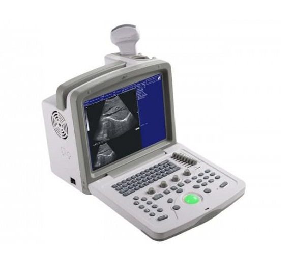 Ultrasound Scanner WED-180