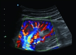 Apogee 2300 Ultrasound Machine- 4D - Image 10